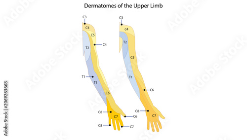 Bild auf Leinwand Dermatomes of the Upper Limb, the dermatomal distribution of cervical and upper thoracic spinal nerves across the upper limb