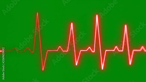 A glowing red heart rate monitor line pulses on a green background