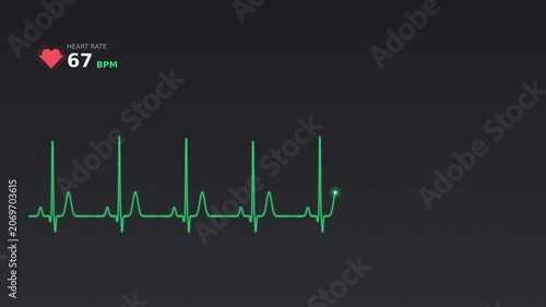 Heart beat rate in cardiogram monitor hospital medic