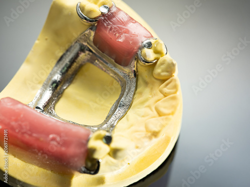The image of a denture