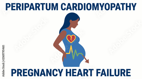 Schilderij op canvas Peripartum Cardiomyopathy Pregnancy Heart Failure Vector
