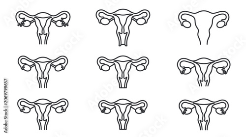 Uterus Anatomy Icons Set - Female Reproductive System Outline Graphics