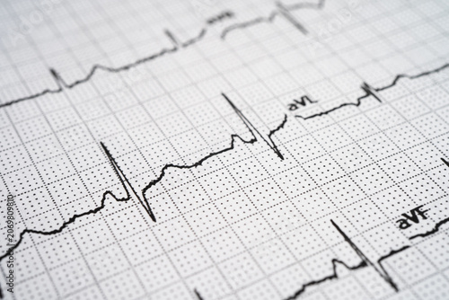 Red heart on electrocardiogram ECG with red heart, heart wave, heart attack, cardiogram report.
