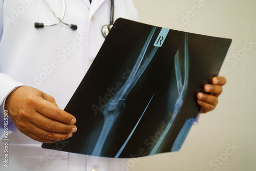 Foto Doctor examining hand ankle joint bone radiography xray film.