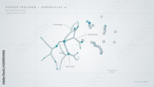 Clean clinical microscopy of transparent fungal hyphae and spores, isolated on white with soft blue laboratory accents, ultra-detailed microbiology diagnostics, scientific realism