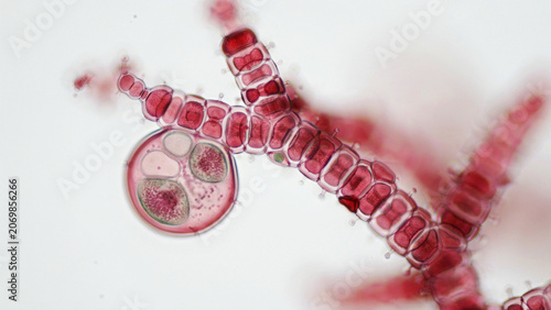Microscopic view of branching red algae filaments and reproductive cell with microscope filament branching microscopic structure freshwater research