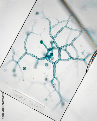 Microscopic view of filamentous fungal mycelium on a microscope slide with mycelium microscope laboratory mycology microorganism research microbiology