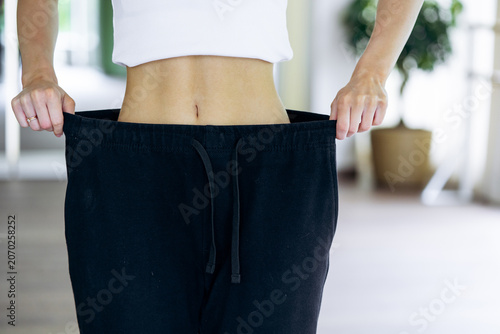 Young woman proudly showing slim waist and oversized pants after successful weight loss, healthy lifestyle and fitness progress
