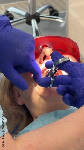 Complete dental filling procedure with patient dentist microscope anesthesia rubber dam and modern restorative treatment set. professional dental care.