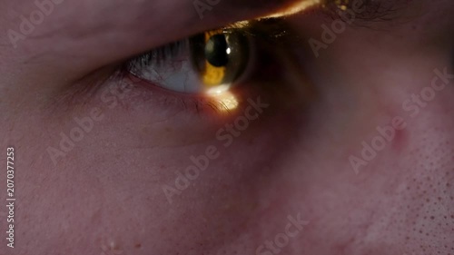 Close up of human eye with golden reflection. Vision diagnostics with a device, close-up of the pupil. Macro photography of the eye.
