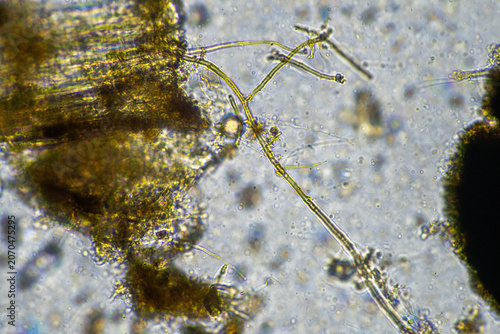 Microscopic view of fungal hyphae and organic matter in a biological soil health analysis