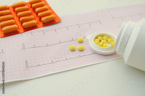 Obraz na płótnie Indications for an electrocardiogram (ECG)