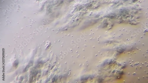 Yogurt bacteria under microscope 