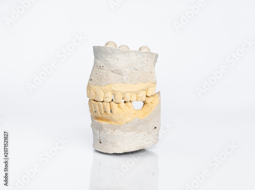 Dental stone model of human jaws isolated on white