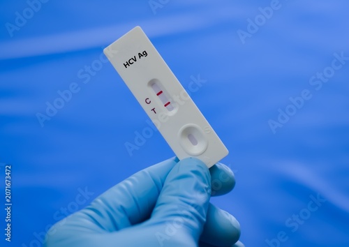 Blood sample of patient positive result for HCV Ag.