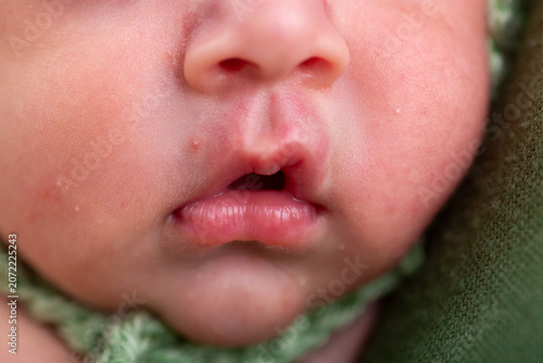 Lovely and little newborn caucassian baby mouth and nose
