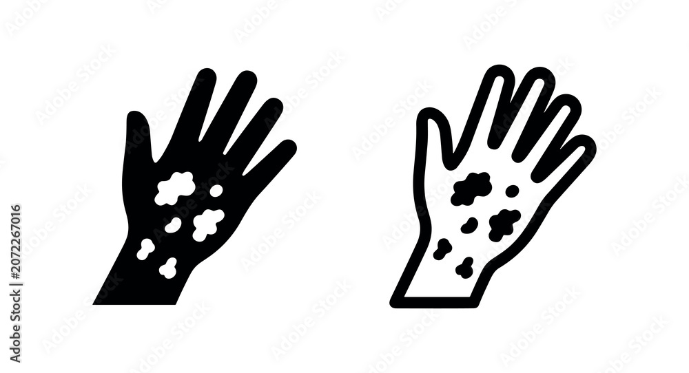 Fototapeta premium Skin Rash and Allergic Reaction Icon on Hand, Dermatology Concept