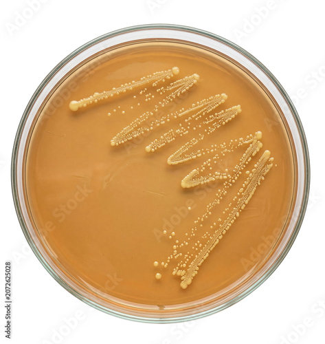 Top View of Bacterial Colonies Growing in a Glass Petri Dish