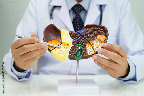 Foto Cirrhosis, Liver cancer, fatty liver, Asian doctor with liver human anatomy model in World Hepatitis Day at hospital