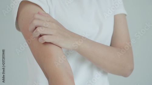 skin problem and beauty. woman scratch body has itchy skin from skin allergic, steroid allergy, sensitive skin, red from sunburn, chemical allergy, rash, insect bites, Seborrheic Dermatitis.