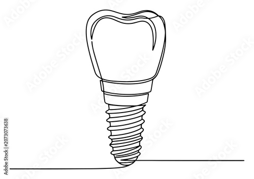 Foto Dental implant screw with a tooth crown in continuous line art style
