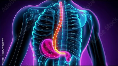 Medical animation showing gerd and acid reflux in stomach. 4K Video