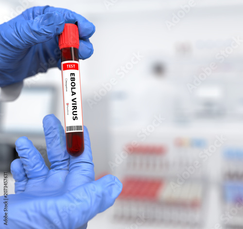 Doctor holds in his hand a blood test tube for Ebola virus with a positive result
