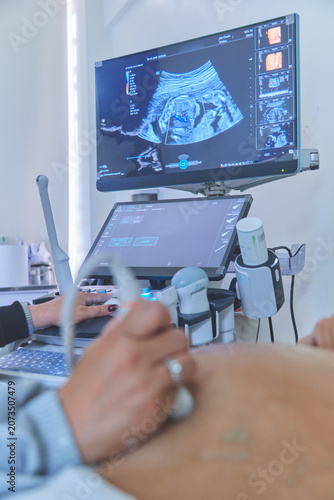 Doctor performing ultrasound scan examining fetus on screen for prenatal health