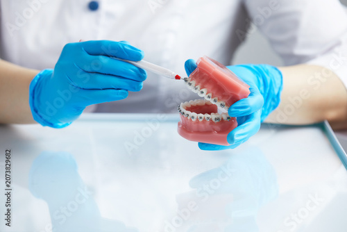 Fotografía Doctor orthodontist showing model of human jaw with wire braces attached