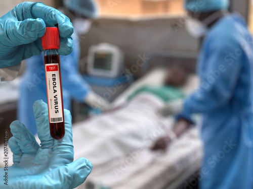 Doctor holds in his hand a blood test tube for Ebola virus with a positive result