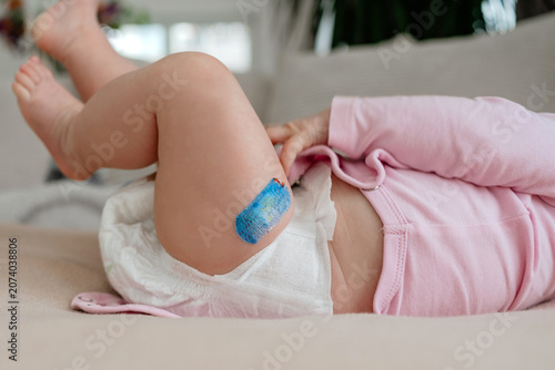 Baby lifting legs on bed with vaccine plaster, Active infant in diaper with medical band-aid