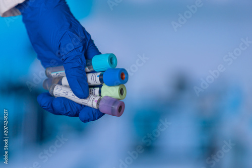 Blue gloved hand holds test tubes. Tubes have varied colored caps. Background shows lab setting. Hand appears steady and professional. Image captures clinical precision