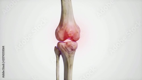 Detailed CGI Visualization of a Human Knee Joint Featuring Bones, Ligaments, and Cartilage on Clean White Background for Medical and Educational Use