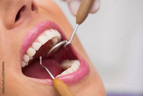 Konstfotografi Dentist examining female patient teeth