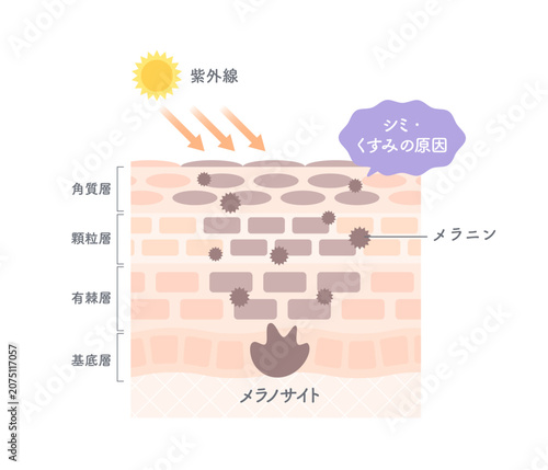 紫外線によるシミ・くすみの原因とメラニン生成を解説する肌断面図イラスト