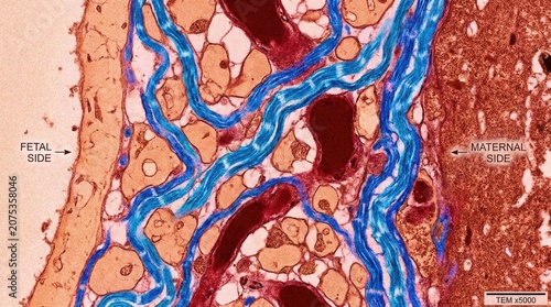Placental barrier tissue demonstrating microscopic cellular structure, visualizing potential pathways for plastic dangers.
