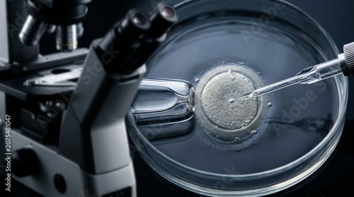 A microscopic view of a micropipette introducing sperm to an ovum during in vitro fertilization