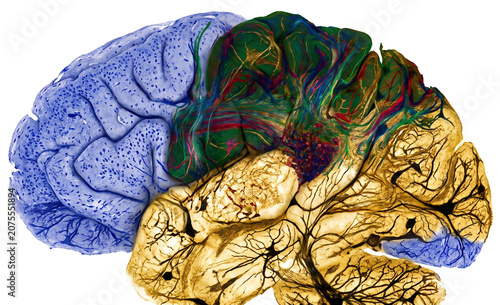 brain