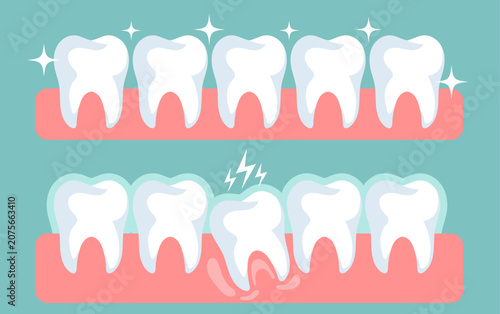 Healthy White Teeth with Sparkles Illustration Collection