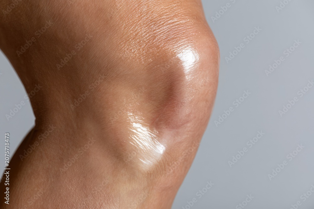 Fototapeta premium Close up of human knee joint with glossy skin and pain relief cream concept