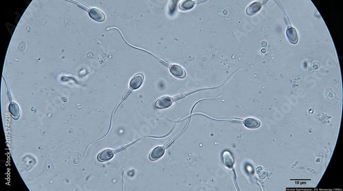 Microscopic view of human sperm cells swimming in semen sample