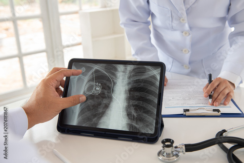 Photography cardiothoracic surgeon team looks medical x-ray image of pacemaker implantation cardioverter defibrillator in chest patient at hospital