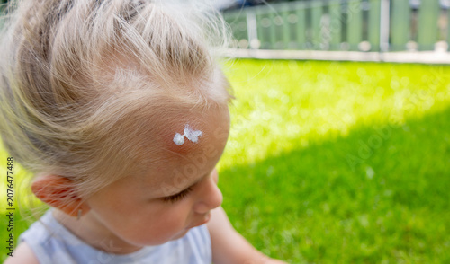 Applying soothing cream to a mosquito bite on a little girl's forehead