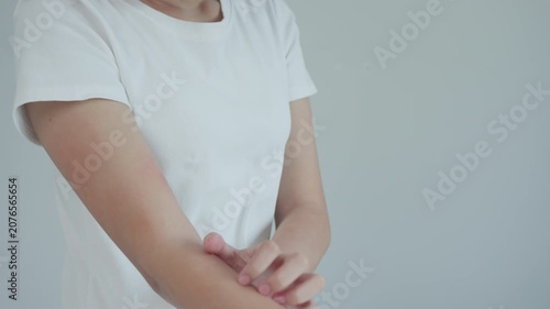 skin problem and beauty. woman scratch body has itchy skin from skin allergic, steroid allergy, sensitive skin, red from sunburn, chemical allergy, rash, insect bites, Seborrheic Dermatitis.