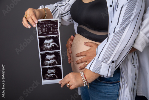 Pregnant big belly holding a ecography sonography baby scan