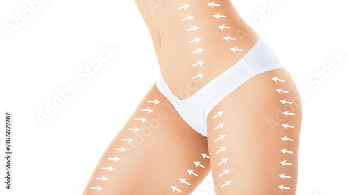 Slim female hips and belly in white pants with correction arrows on areas for aesthetic medicine intervention, isolated on white background.