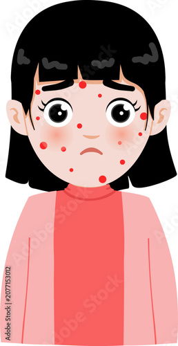 Cartoon Illustration of a Girl with Chickenpox