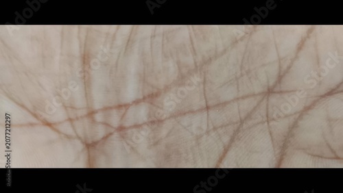 Fotografie Close-up of delicate human skin with visible veins and capillaries