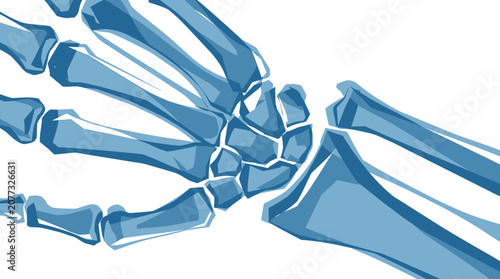Human hand and wrist bone structure x-ray style