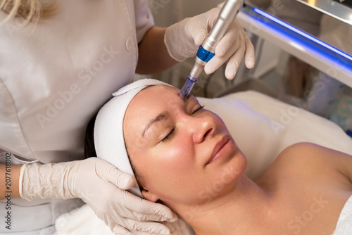 Woman undergoing professional microneedling facial skincare procedure for beauty and rejuvenation
